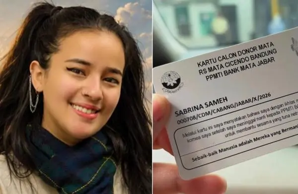 Mengejutkan! Sabrina Sameh Donorkan Kedua Matanya
