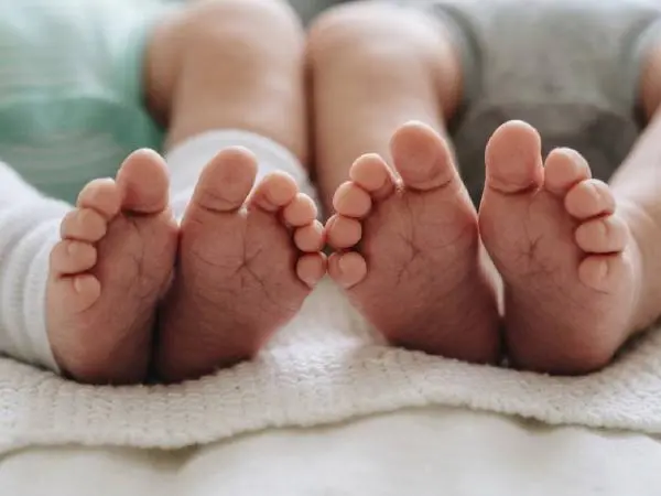 Kondisi Terkini Bayi Kembar Siam yang Dipisahkan di RSCM, Jalani Pemulihan Terpisah
