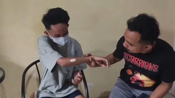 Ngeri! Geng Motor Busur Pemuda di Gowa, 2 Anak Panah Tertancap di Pipi dan Lengan